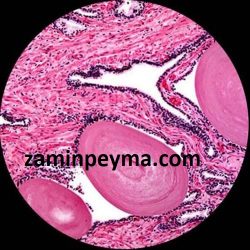 میکروسکوپ سه چشمی 1600 برابر طرح المپیوس.. نمونه ای از کیفیت دید میکروسکوپ سه چشمی